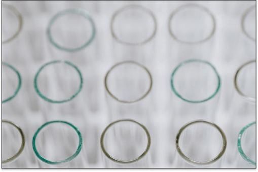 Ketamine treatment response predictors - biomarkers and clinical factors